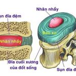 Giải phẫu chức năng đĩa đệm cột sống