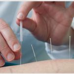 Phương pháp điện châm điều trị đau