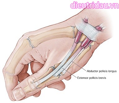 Bệnh lý viêm bao gân cơ dạng dài và duỗi ngắn ngón tay cái
