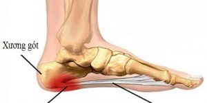 Phác đồ phục hồi chức năng sau tiêm PRP vùng cổ chân - bàn chân